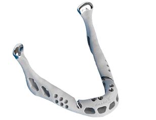 3d打印下頜骨成功移植 置換人體器官不再是夢-e鍵打印|3D打印服務(wù)
醫(yī)療3d打印技術(shù),3D打印下頜骨,3D打印人體器官,3D打印器官,3D打印心臟,3D打印假肢,3D打印大腦,3D打印技術(shù),3D打印服務(wù),3D打印云平臺