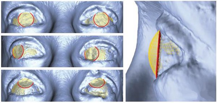 3D打印新技術(shù) 迪斯尼用照片重建繪制3D眼部立體圖_e鍵3D打印服務 3D打印新技術(shù) 迪斯尼用照片重建繪制3D眼部立體圖_e鍵3D打印服務
