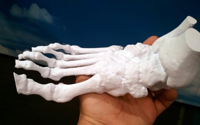 3d打印應用領域之醫療應用_e鍵打印服務公司 3d打印應用領域之醫療應用_e鍵打印服務公司